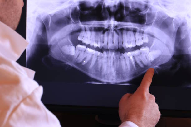 Best Emergency Wisdom Teeth Removal in Mount Pleasant, TX