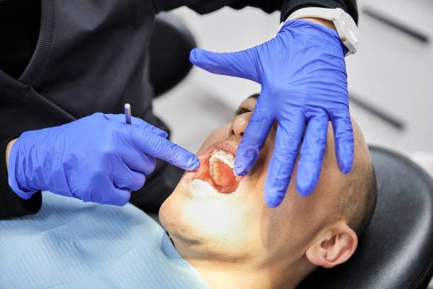 Best Emergency Tooth Extraction in Mount Pleasant, TX